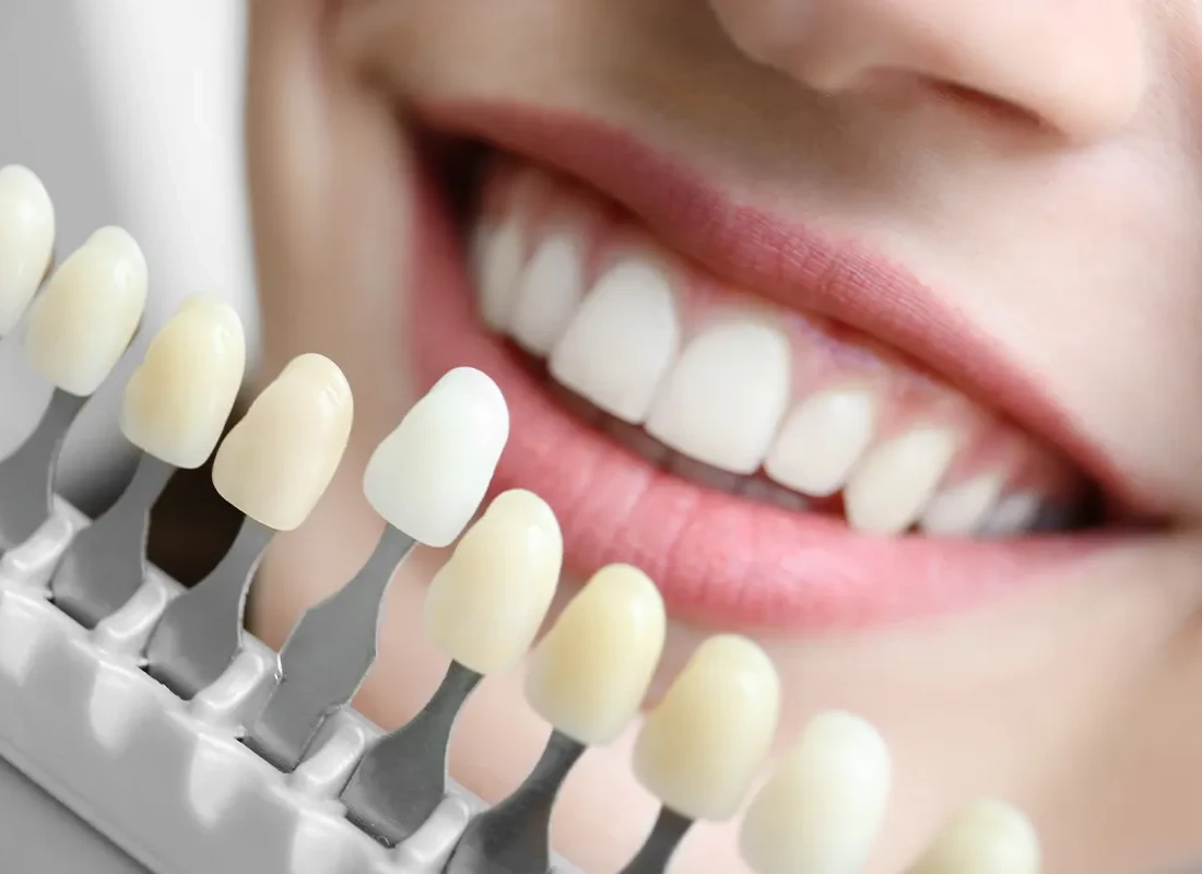 teeth turning yellow