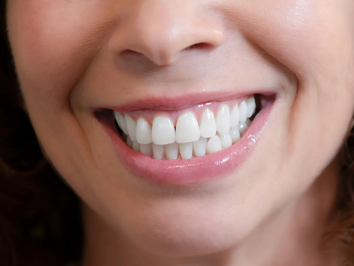 Cosmetic Dentistry
