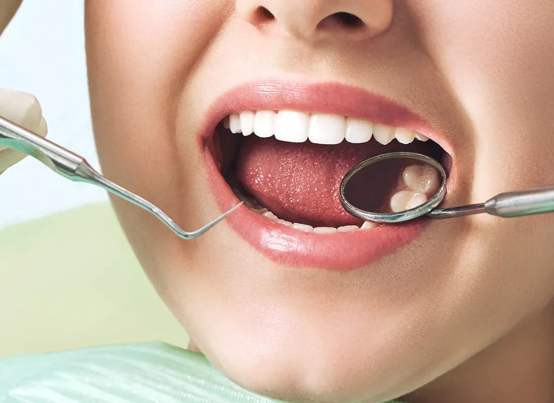 Top 5 Dental Problems Women Face After Menopause — Beverly Hills Cosmetic Dentistry