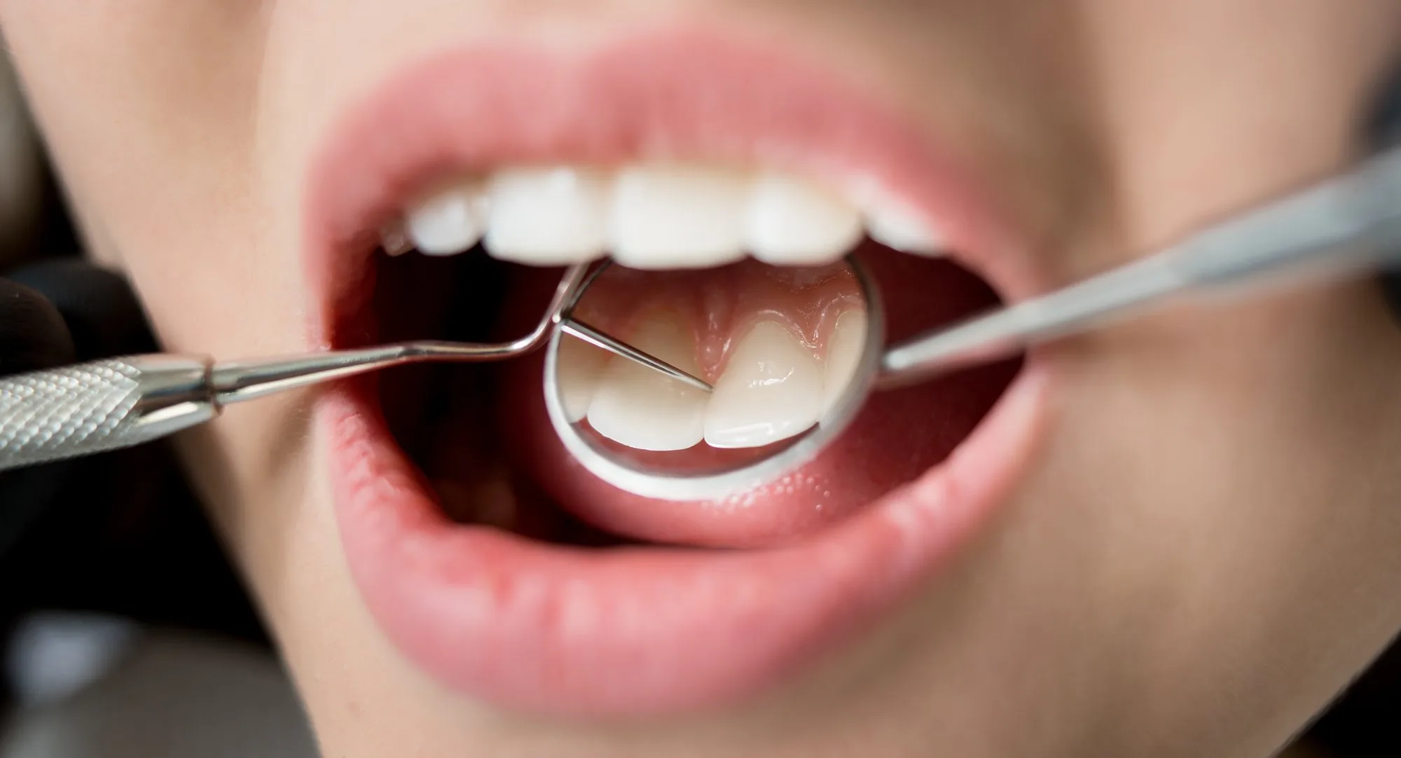 Top 5 Surprising Health Conditions Linked to Gum Disease — Beverly Hills Cosmetic Dentistry