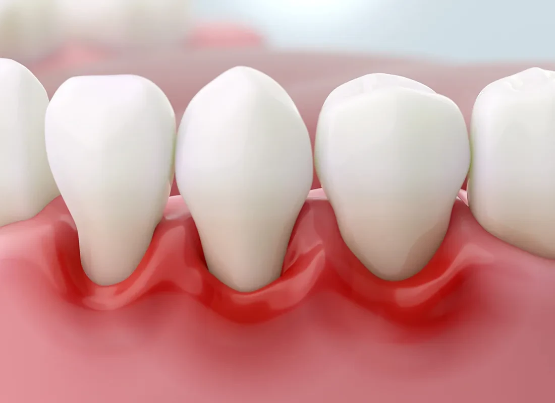 Patient showing gum health