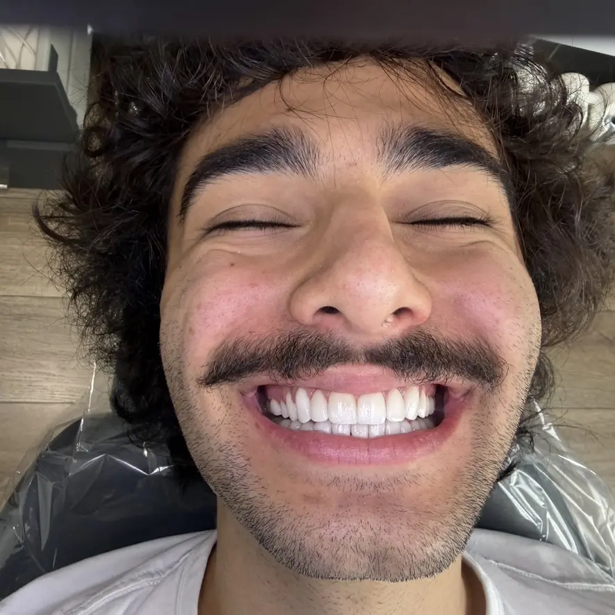 After — Smile Makeover